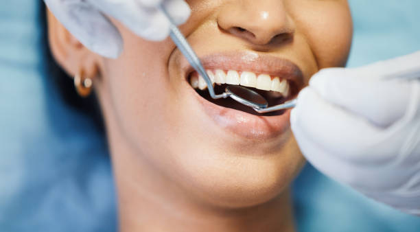Best Lost Filling or Crown Replacement in Gastonia, NC